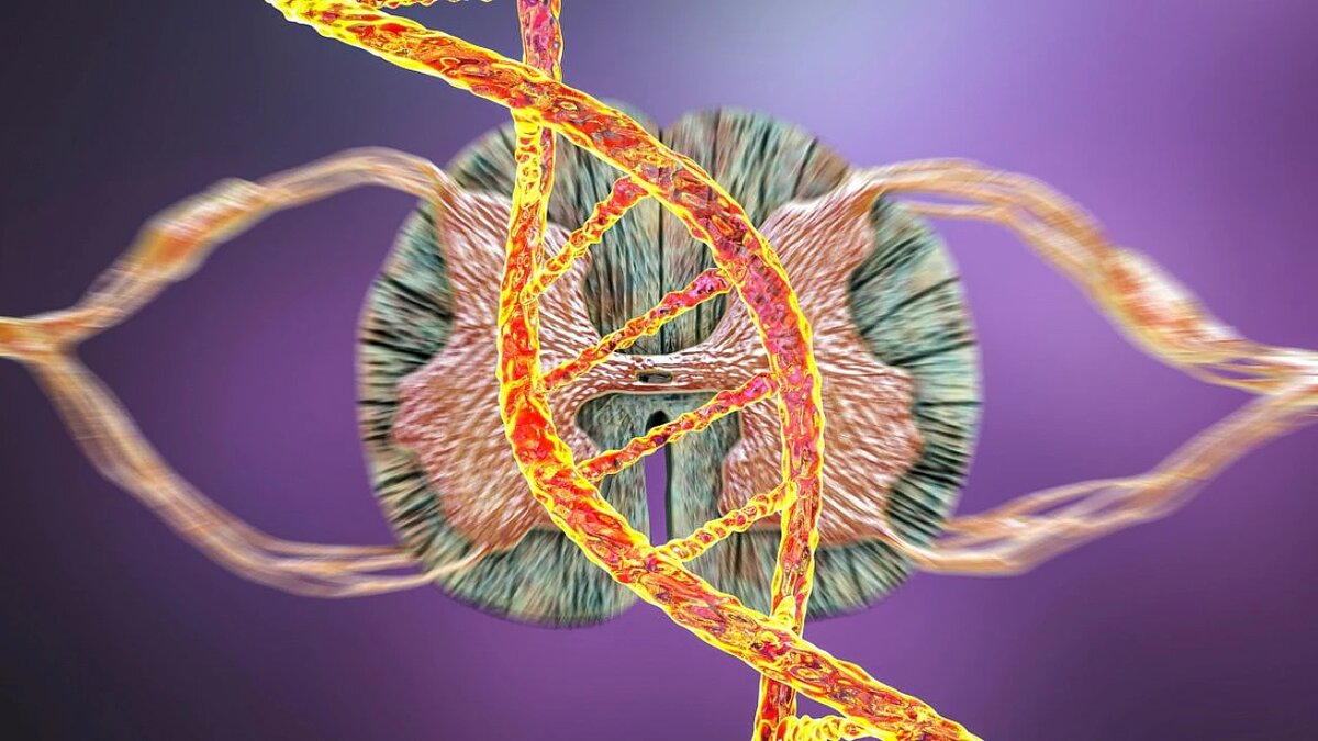 СМА характеризуется атрофией мышц. Рисунок из Интернета. 