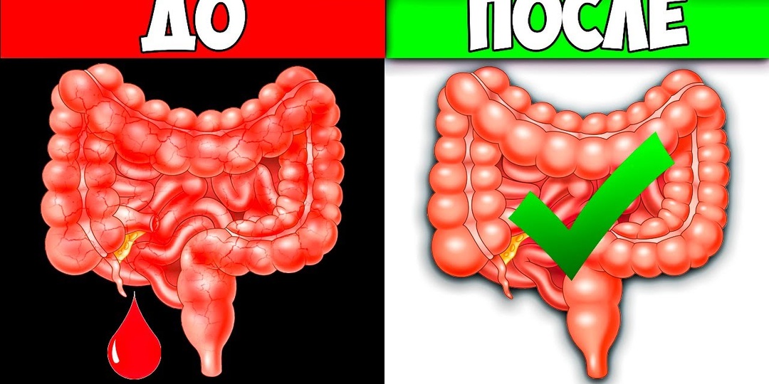 4 признака, что кишечник работает неправильно