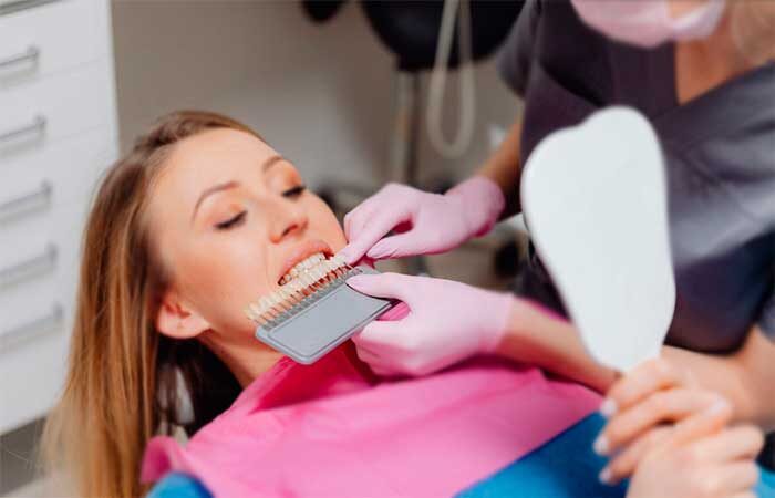 Понимание фарфоровых виниров: подробное руководство