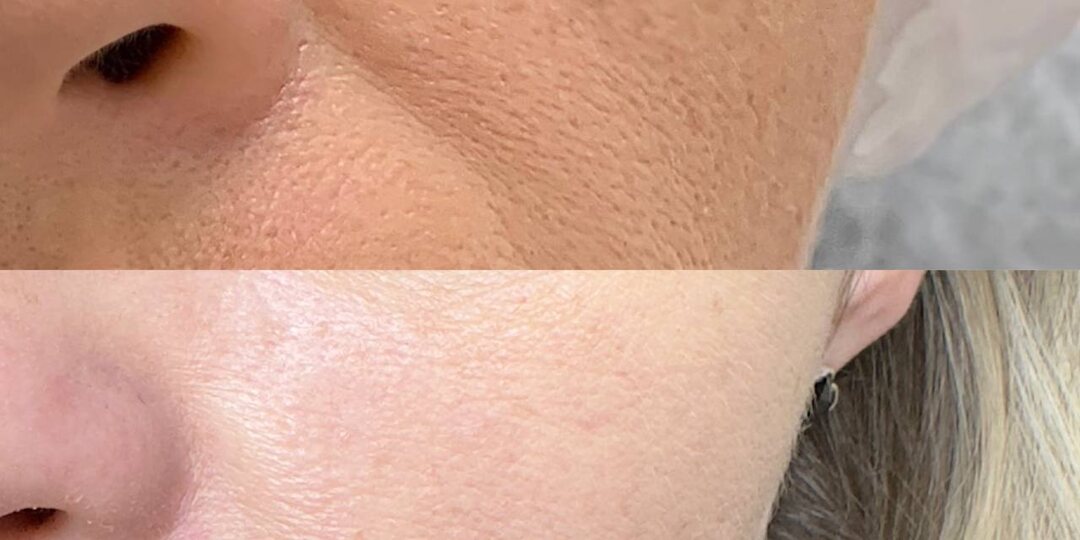 Вчера проводила анализ