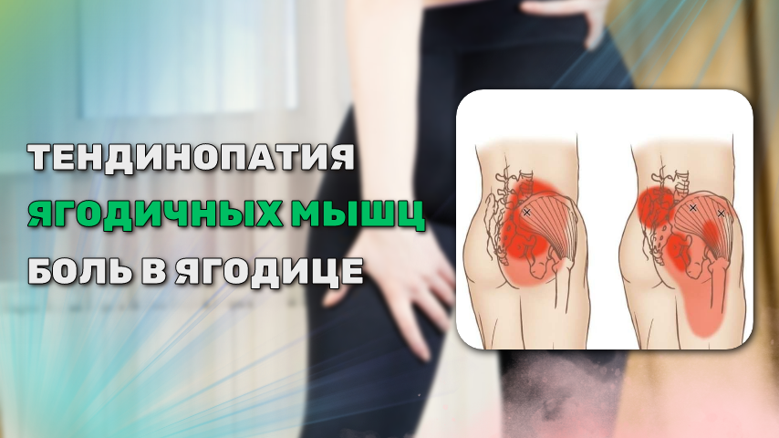 Боль мешает спать на боку и выполнять повседневные задачи, связанные с переносом веса.