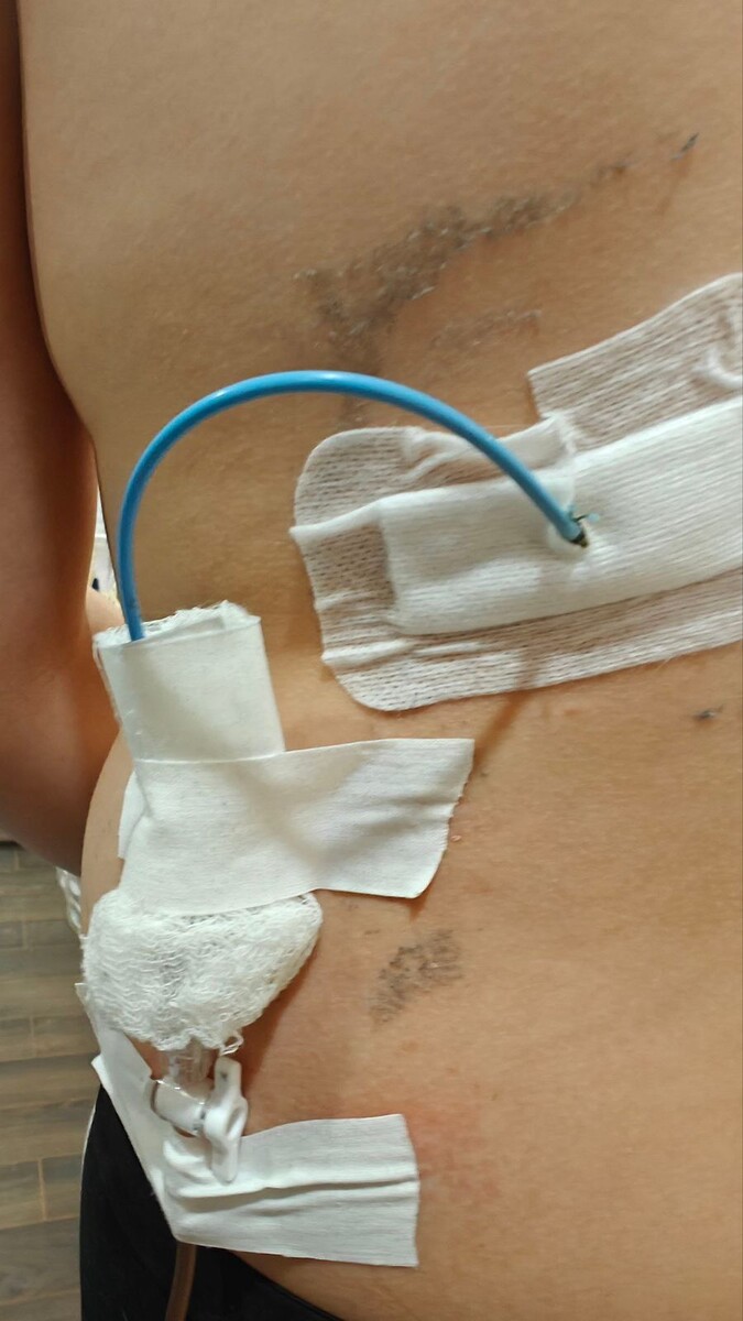 Сделали операцию. Фото предоставлено автором