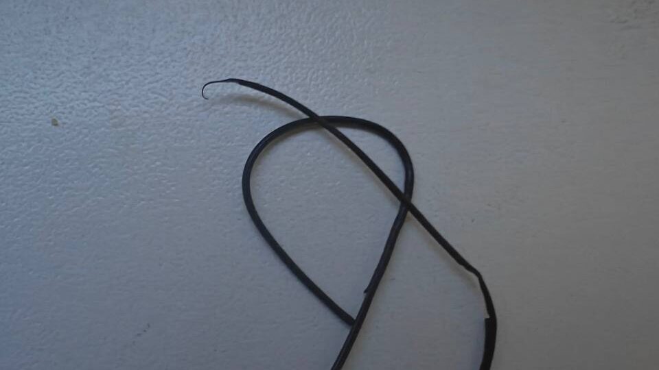 ВРАЧИ ЗАБЫЛИ ИНСТРУМЕНТЫ В ПОЧКЕ РЕБЕНКА