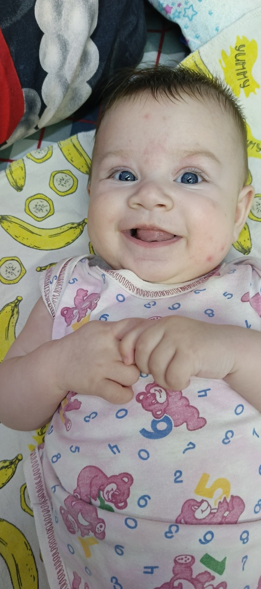 Комары кусаются их вообще ничего не берёт.