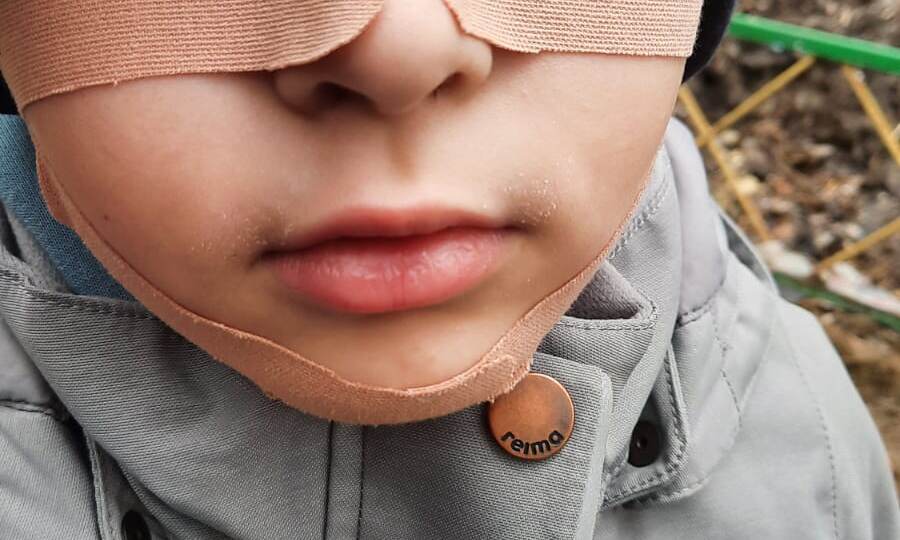 ЗРР, Дизартрия-заключительная часть!