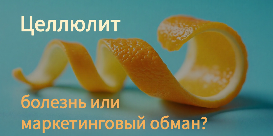 Целлюлит. Болезнь или самый успешный обман в индустрии красоты?