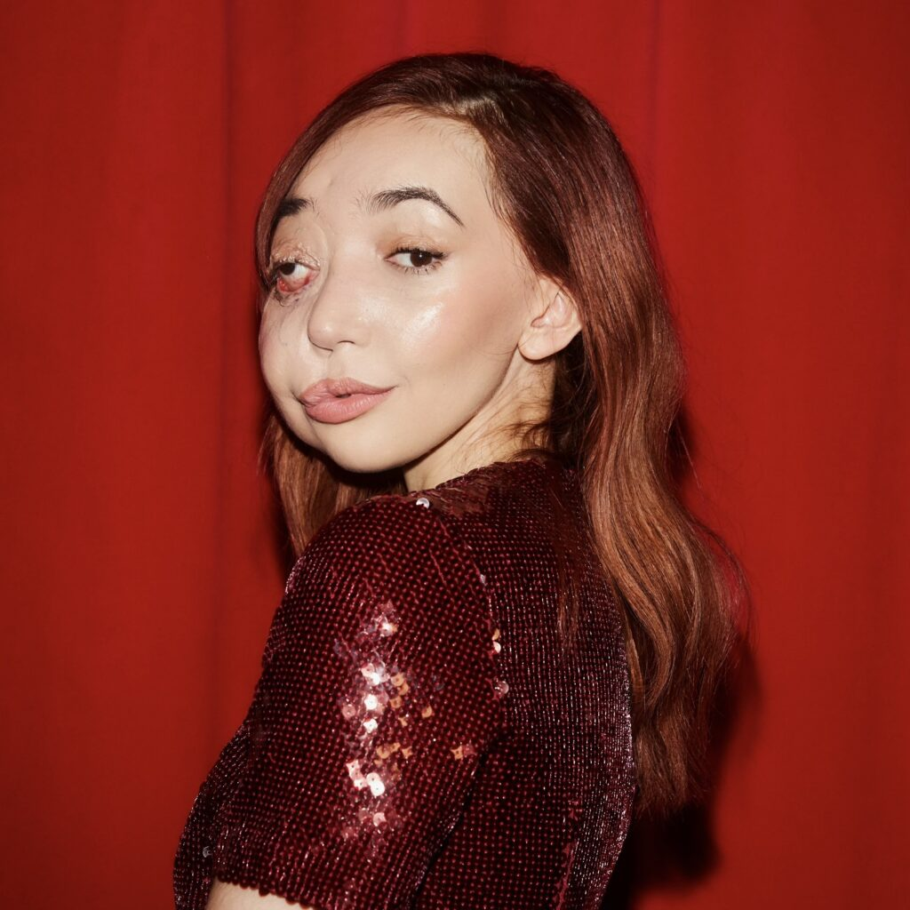 На фото — Никки Лилли, вдохновляющая блогерша и телеведущая из Великобритании, которая с детства борется с редким сосудистым заболеванием. В 2016 году Никки получила премию International Emmy Kids Award. Никки встречалась с британскими премьер-министрами, политиками и знаменитостями, продвигая темы инклюзивности и психического здоровья.