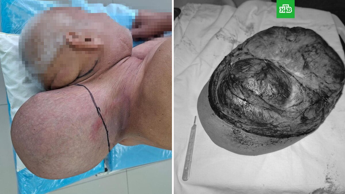    Фото: Минздрав Кировской области / vk.com