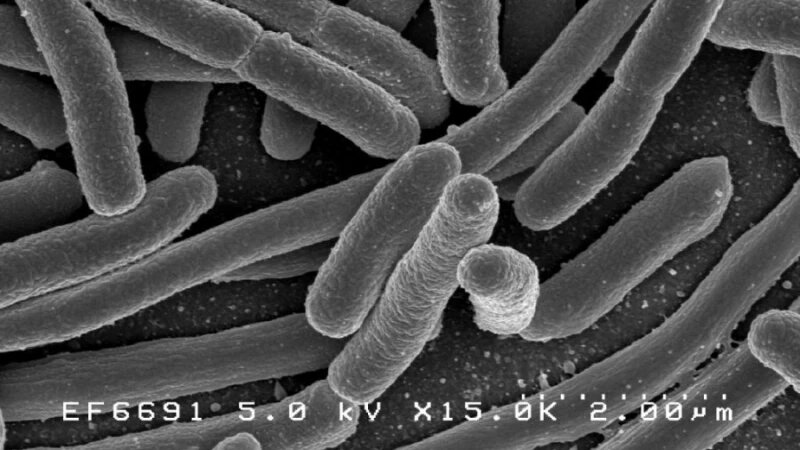     Туберкулез. Легкие. Палочка Коха. СС0.