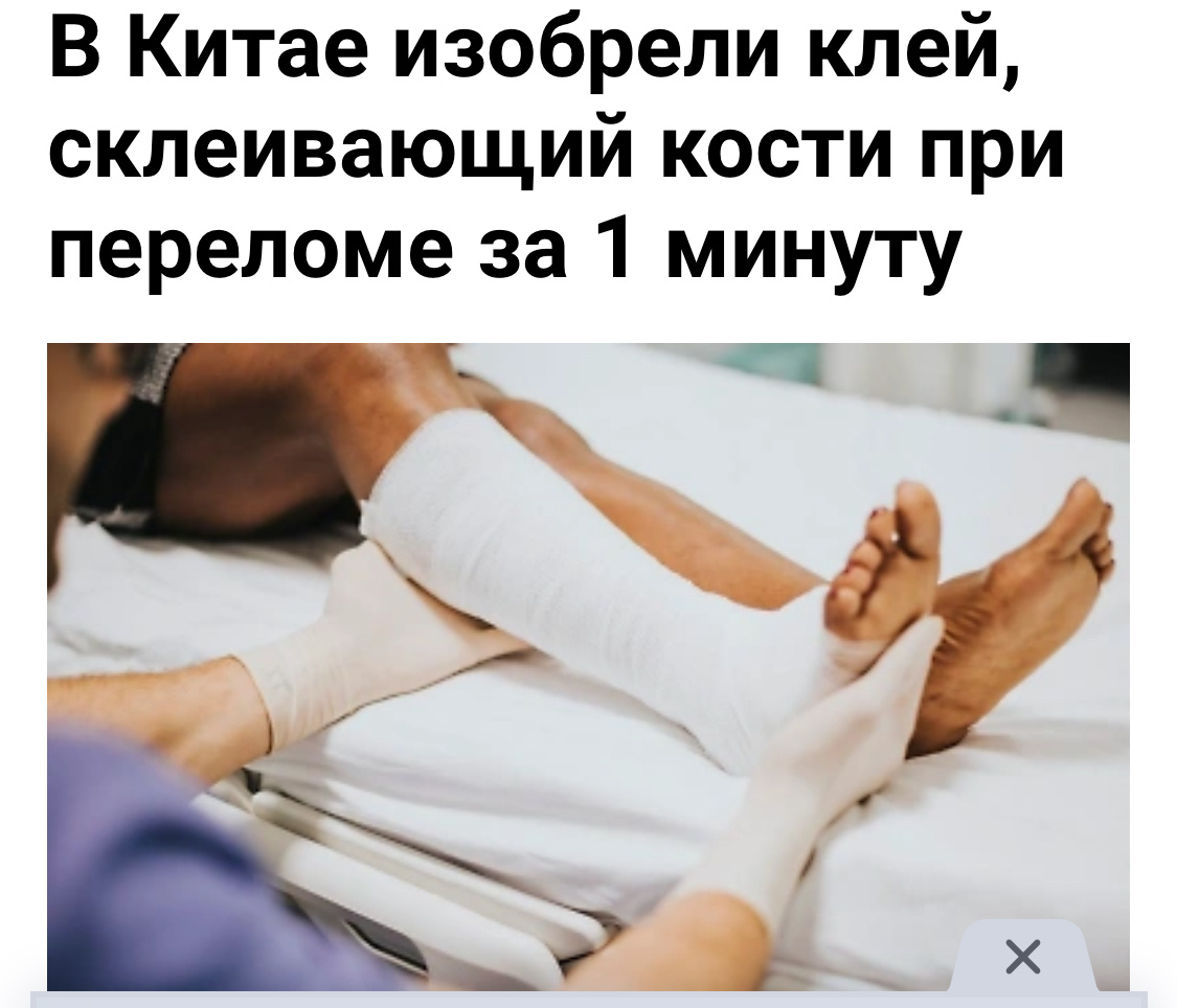 Фото с гипсом почему-то