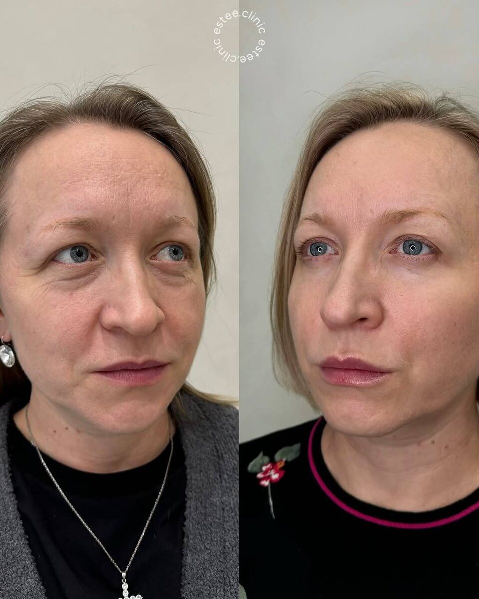 Комплексный протокол 