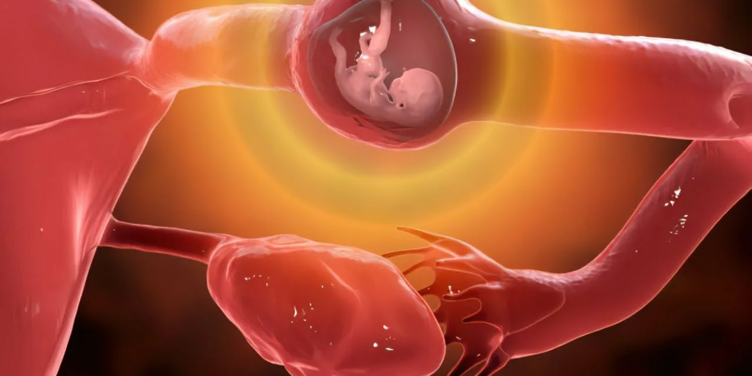 Внематочная беременность: почему она всегда прерывается и чем она так опасна