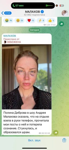    Полина Диброва. Фото: Телеграм