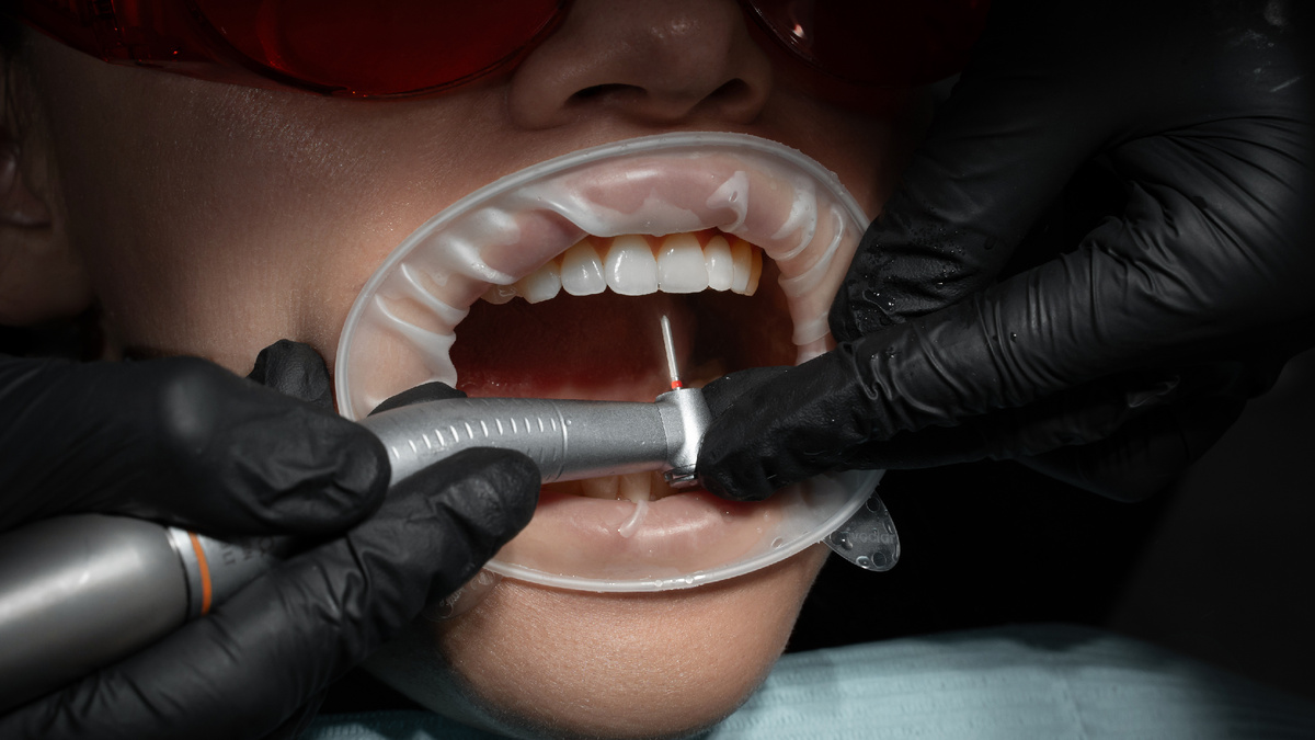 Факторы, которые влияют на возникновение кариеса