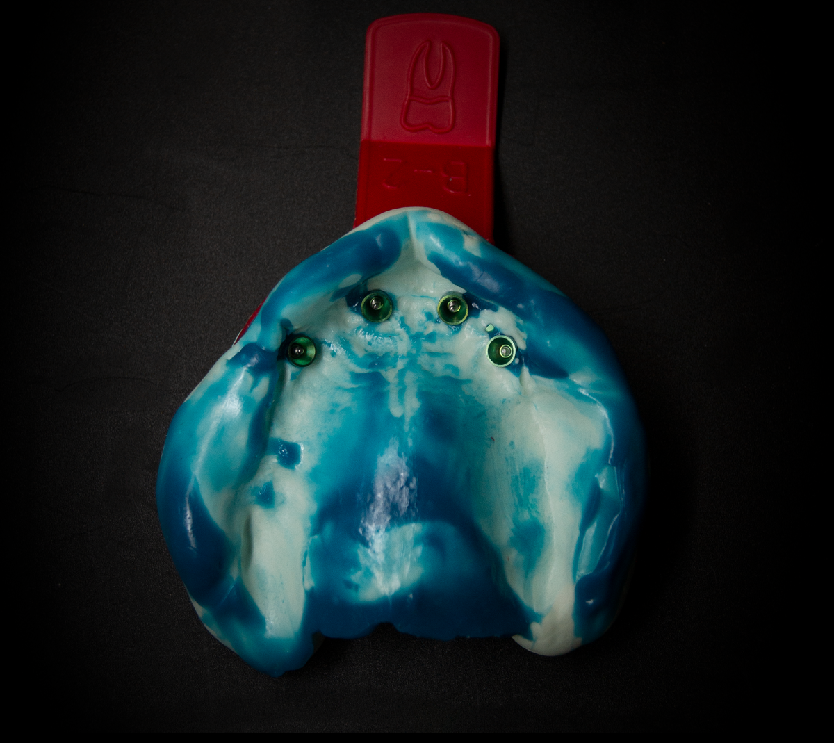 Первоначальный слепок полости рта пациента, верхняя челюсть.