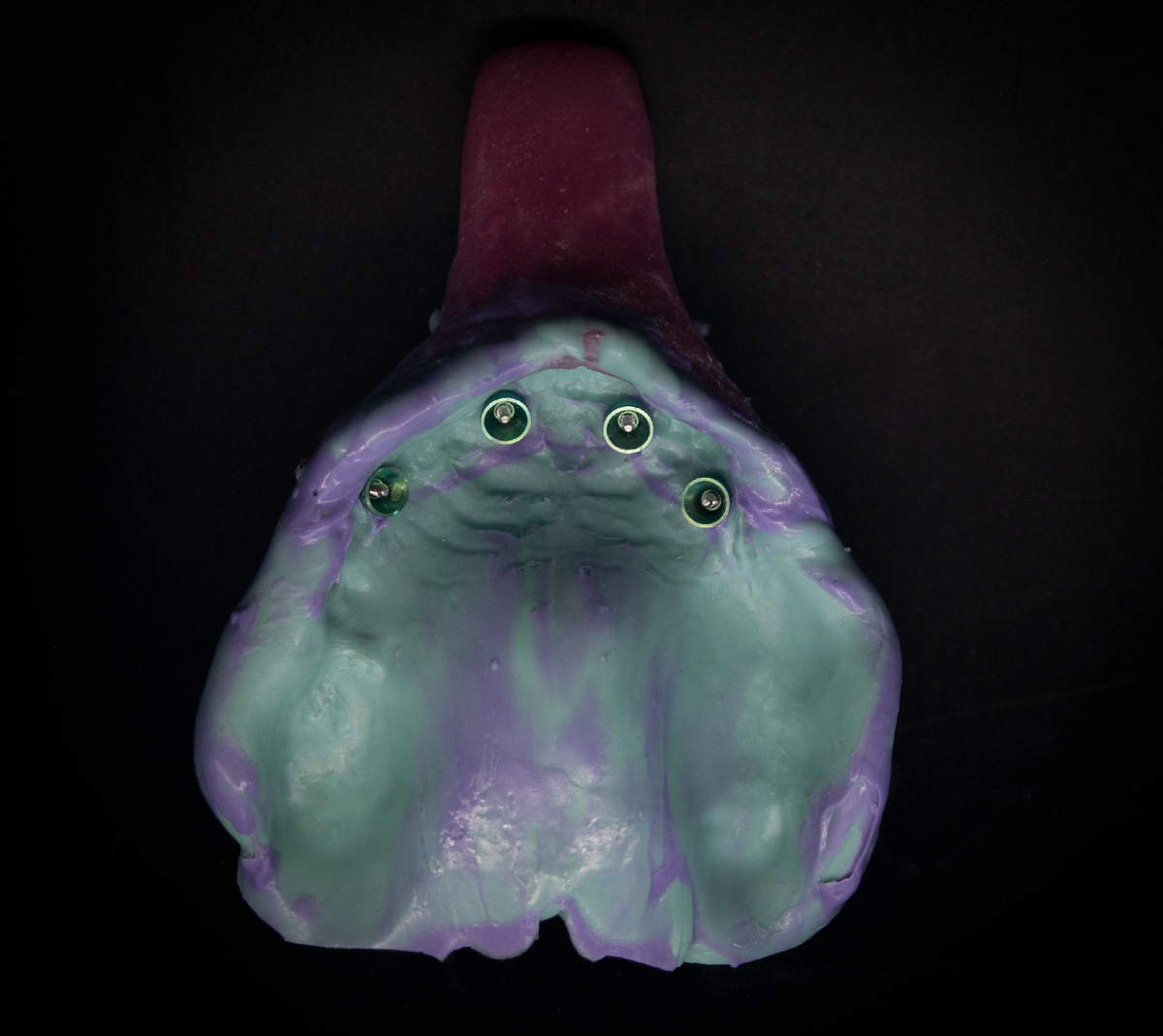 Данные снятые индивидуальной ложкой, верхняя челюсть, с трансфер-чеками внутри.