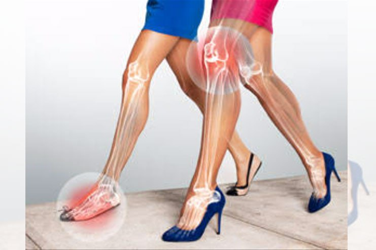 Что же выбрать чтобы не болели суставы?