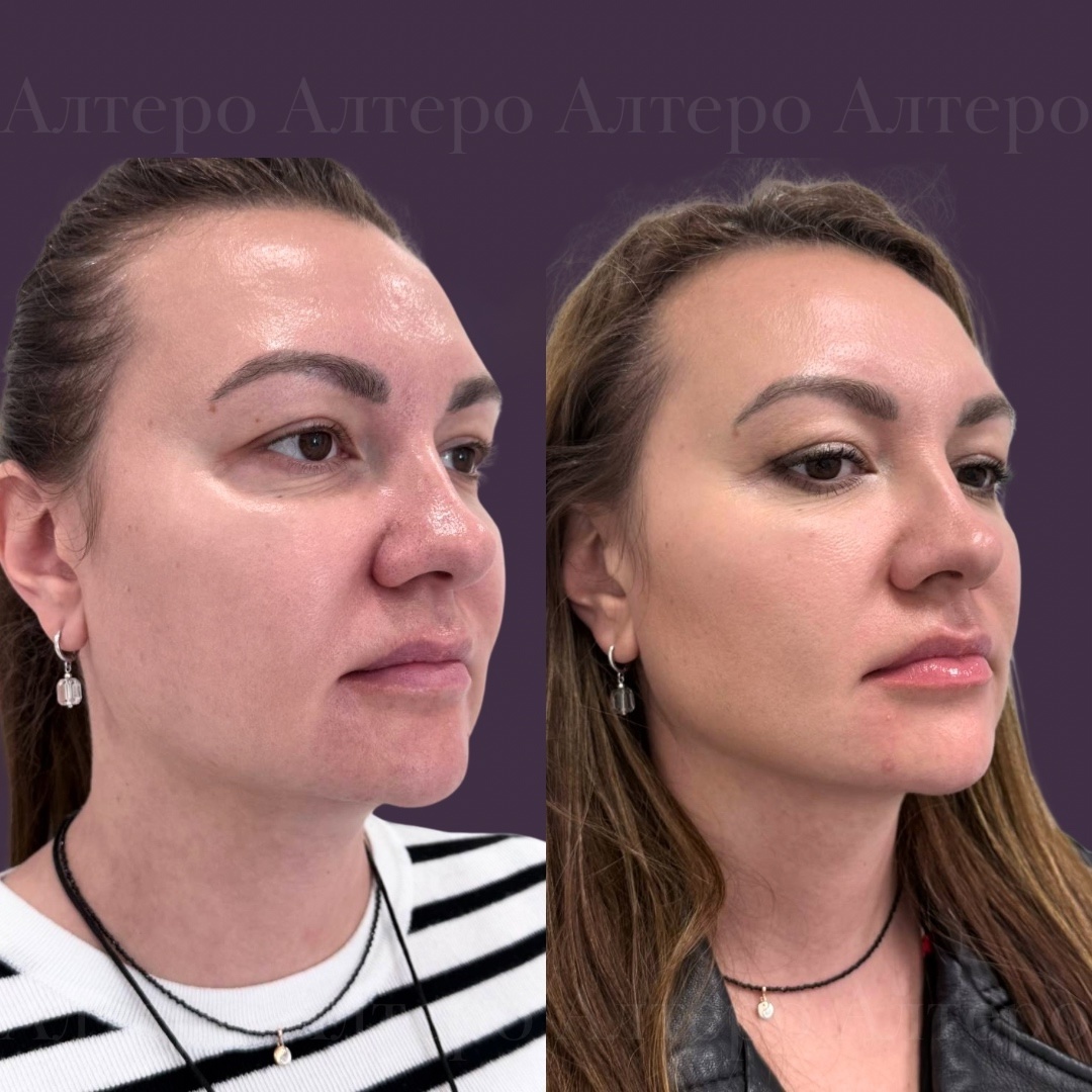 Работа врача Асатрян Н.Г.