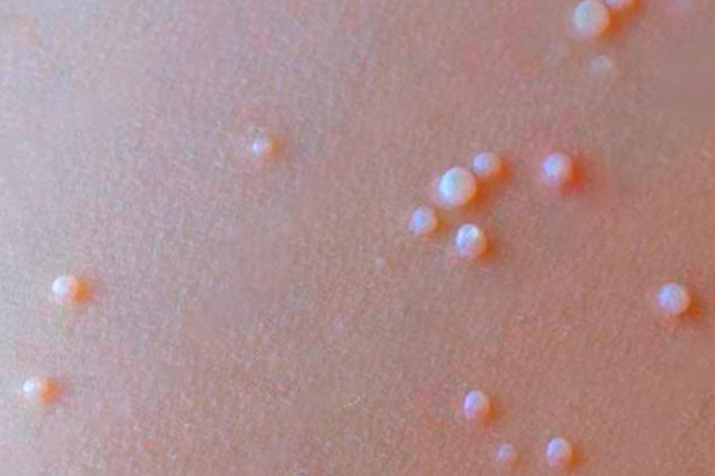    Фото © cgon.rospotrebnadzor.ru