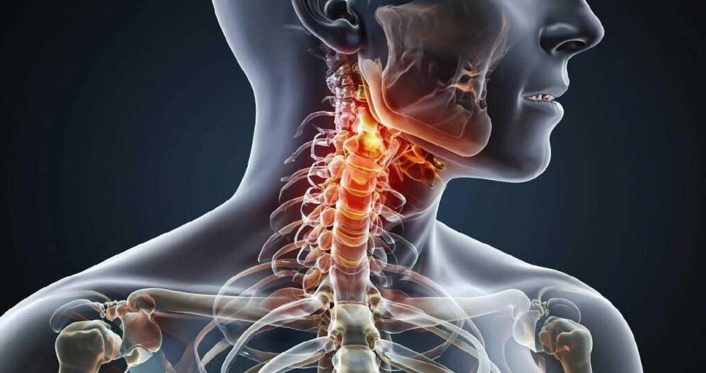 Чувствуете это в шее - конец близок. Первые признаки смертельно опасного заболевания