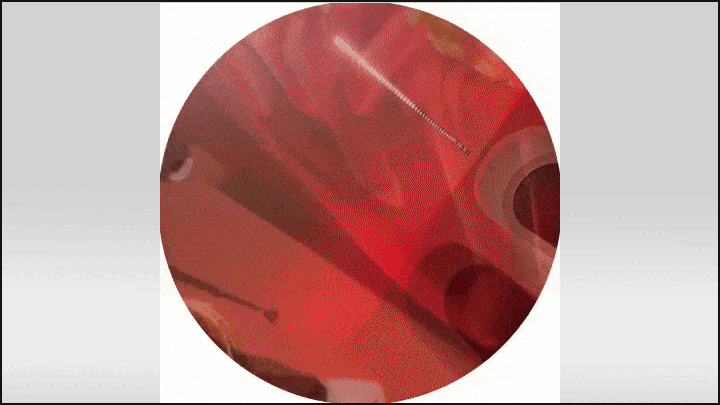    "Вы серьёзно?" Собчак изумила гостей элитной вечеринки килограммами чёрной икры. Видео: Валерия Гай Германика