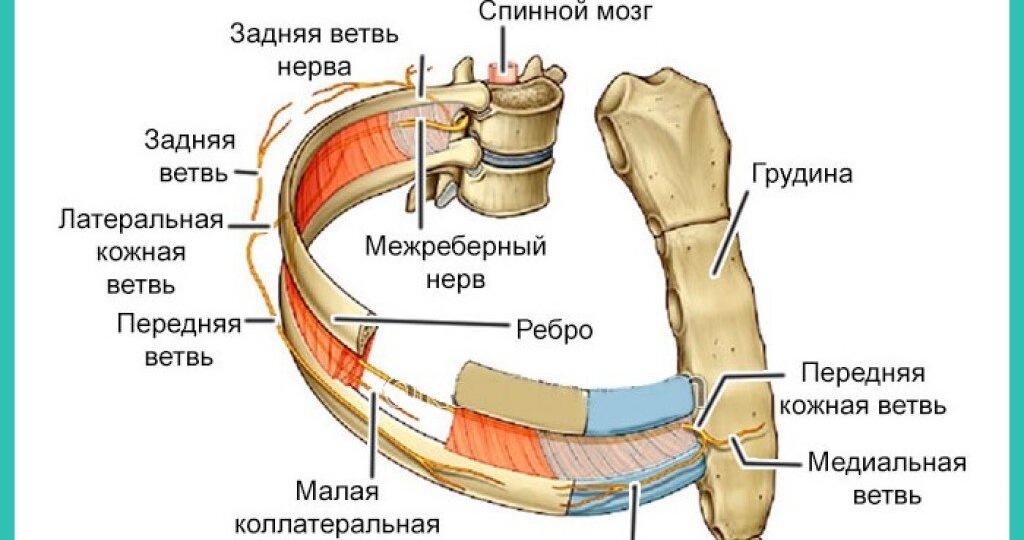 Межрёберная невралгия: как отличить от сердечного приступа и избавиться от боли без таблеток