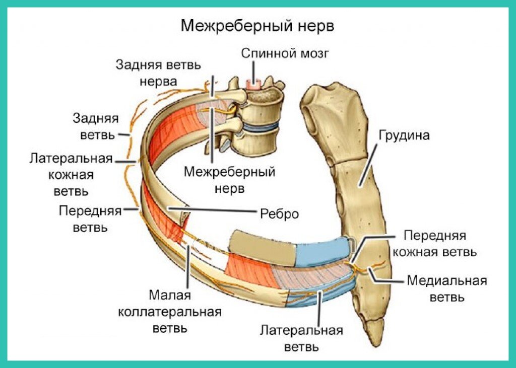 Межреберная невралгия