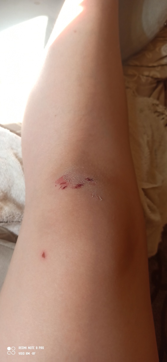 ЗАЕБИСЬ!!!!!!!!!!