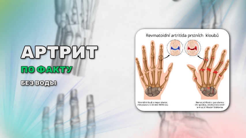 7 полезных привычек при боли в суставах.
