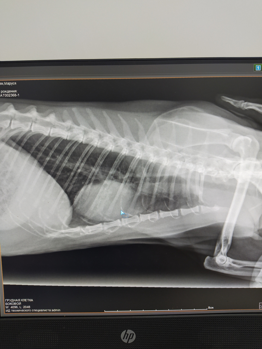 Образование в проекции сердца