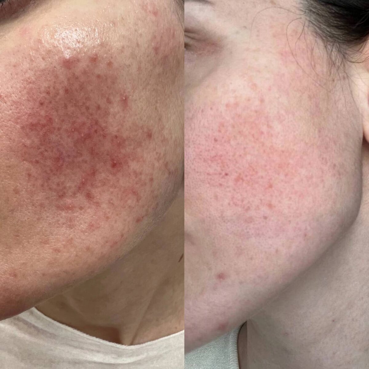 Результаты врачей - косметологов JK Clinic