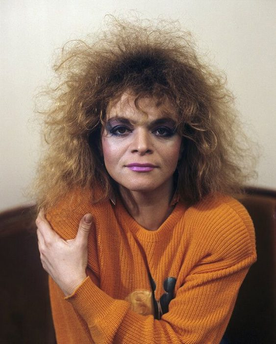 Лариса Долина до пластики