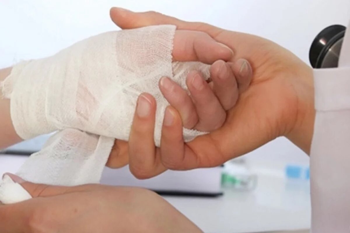    В Башкирии подросток получил ожоги при пожаре