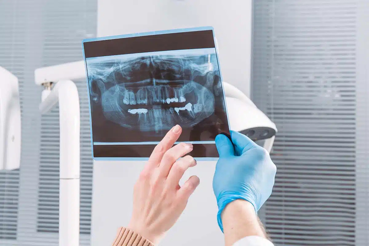 Оценка состояния объема костной ткани по снимку