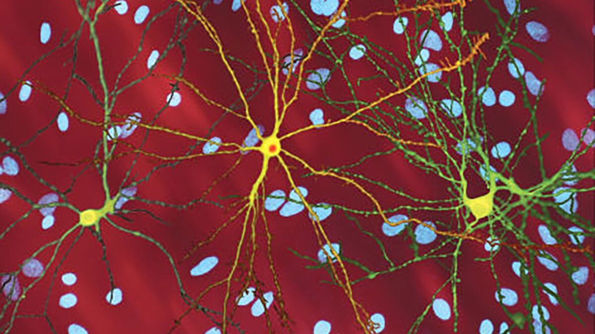   University of California San Francisco