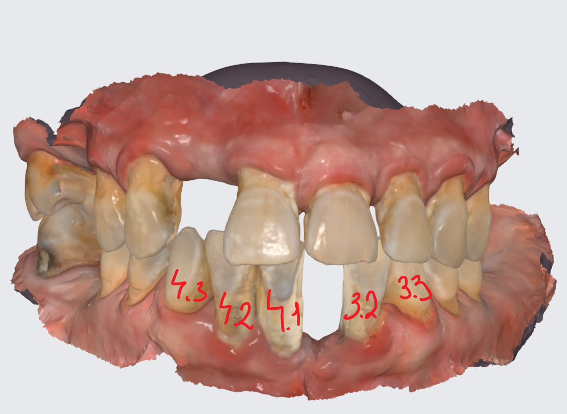 Ситуация до, с этим пациентка пришла