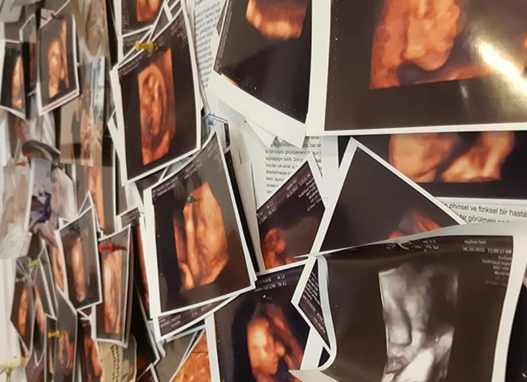 Иллюстративное фото