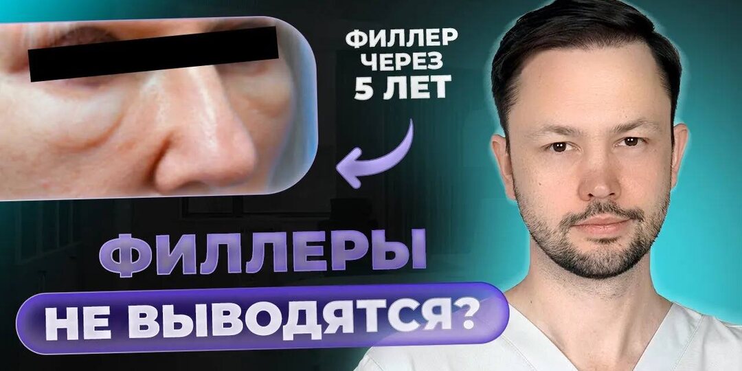Отекшее лицо. Филлеры остаются навсегда?