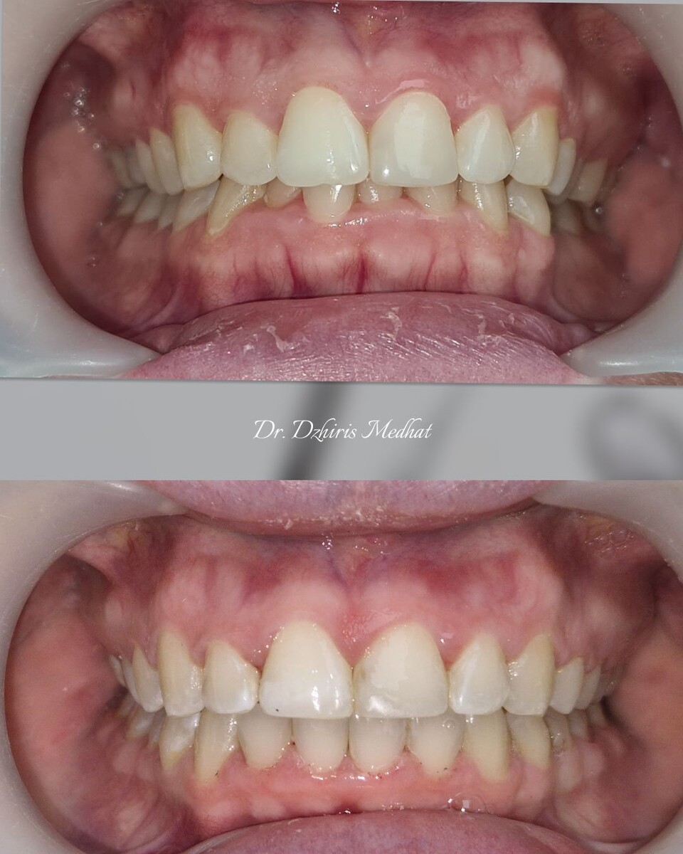 Фото ДО/ПОСЛЕ