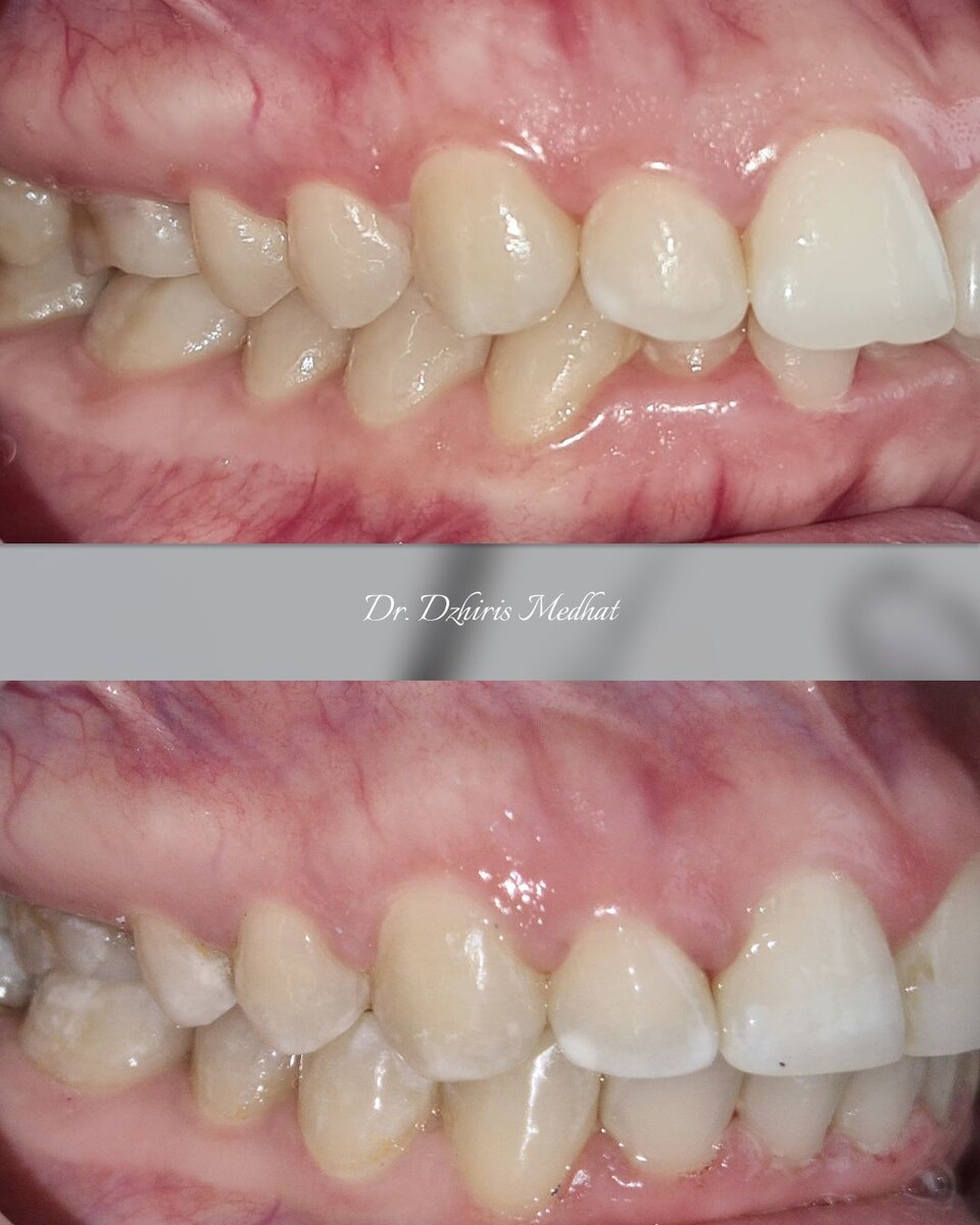 Фото ДО/ПОСЛЕ