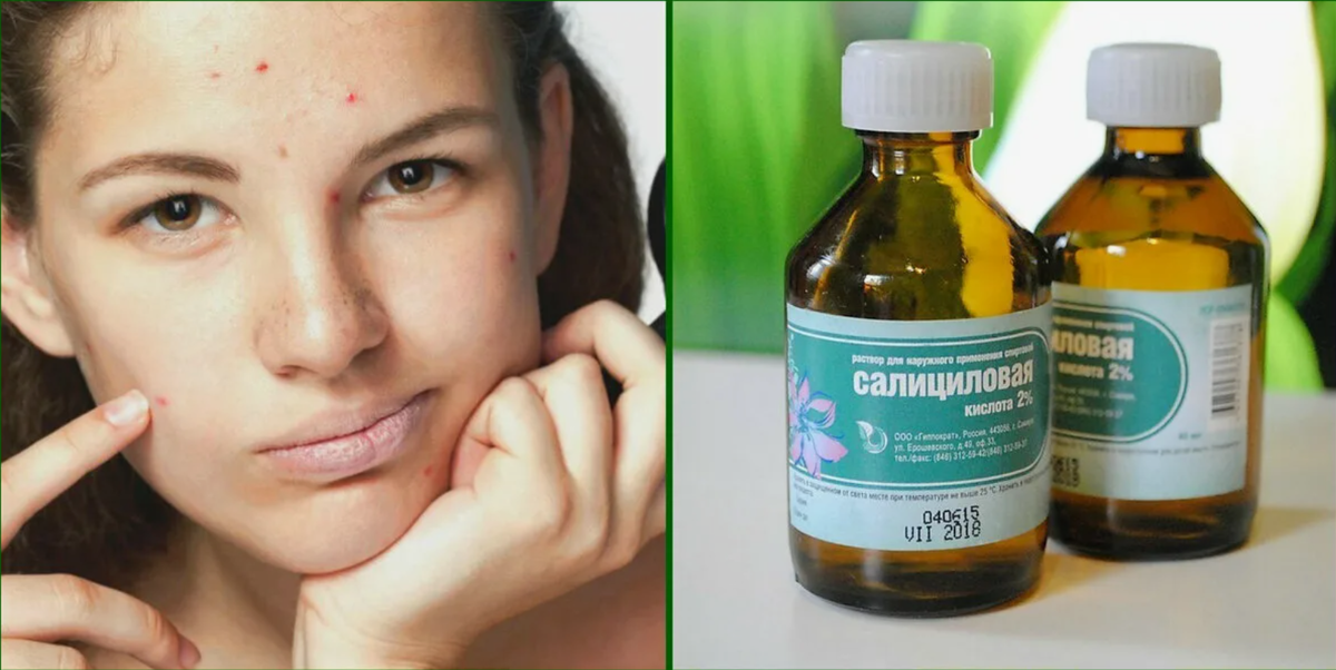 Салицил - одно из самых эффективных средств для чистой кожи