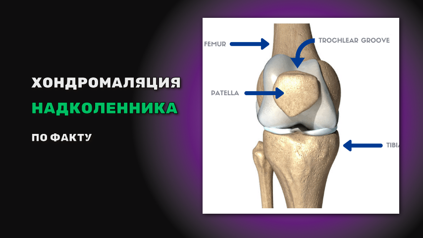 Болит под коленной чашечкой. Что это такое?