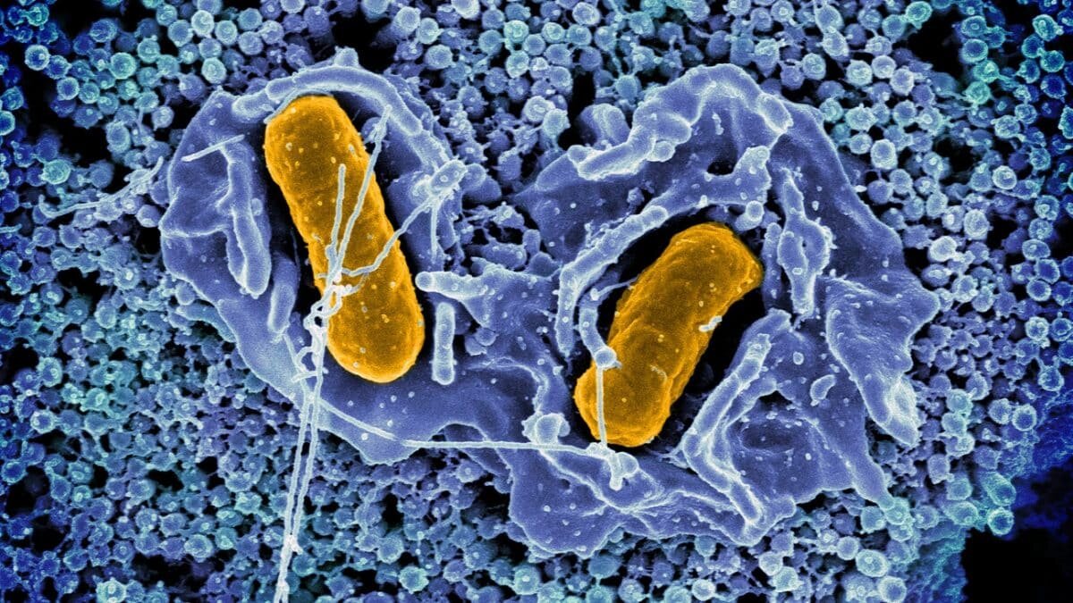    Salmonella Typhimurium / © NIAID, flickr