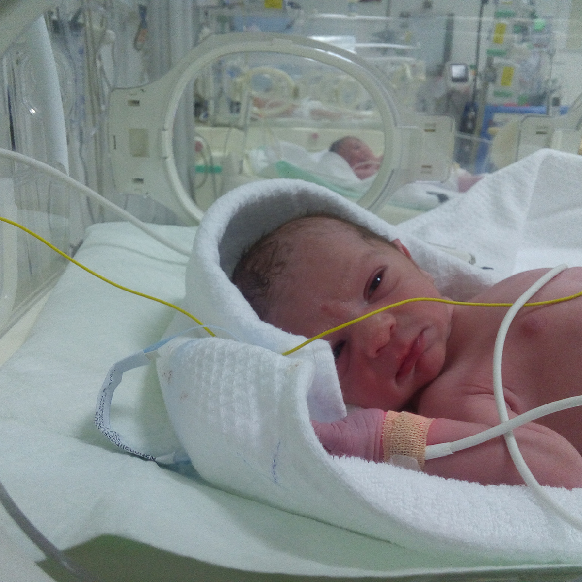 Юнис сразу после рождения