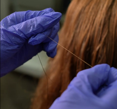 Тест на эластичность перед процедурой