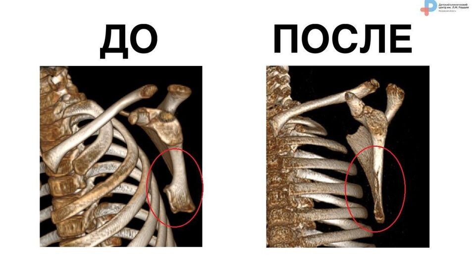    пресс-служба Детского клинического центра имени Л.М. Рошаля