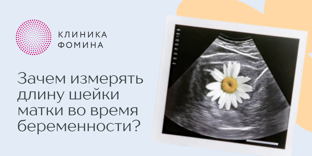 Зачем нужно знать длину шейки матки во время беременности?