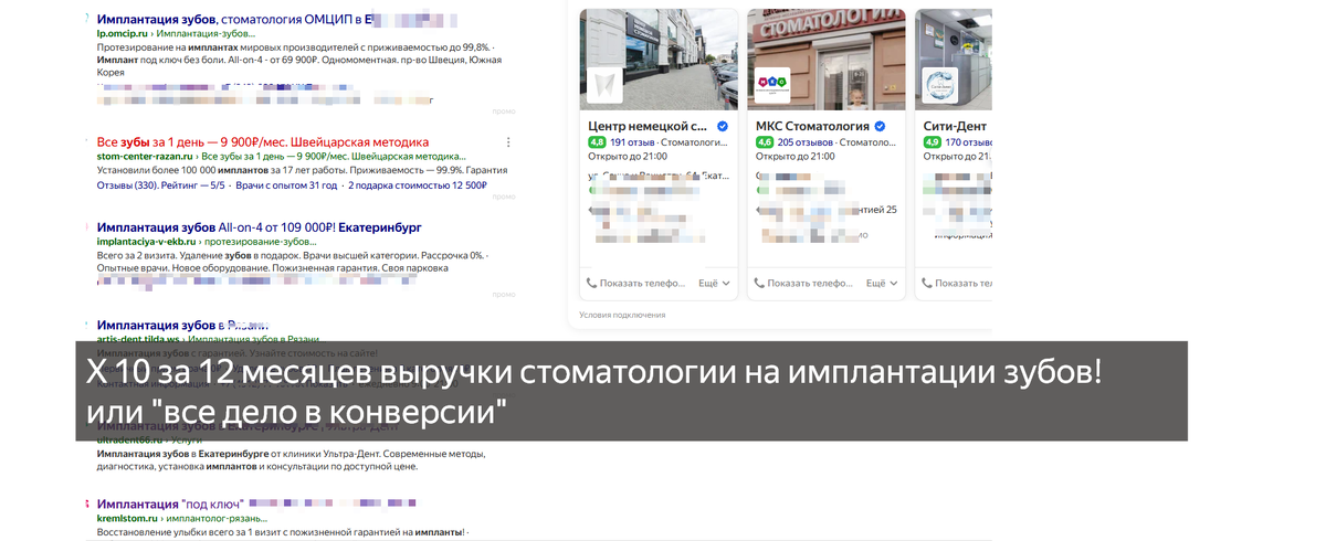 Поисковые выдачи на "имплантация зубов". Скрин с экрана. Продвижение стоматологий при помощи контекстной рекламы в Яндекс Директ.