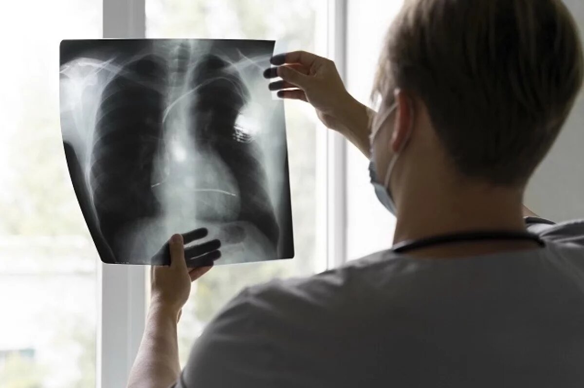    Заболеваемость туберкулезом в Новосибирской области снизилась в два раза