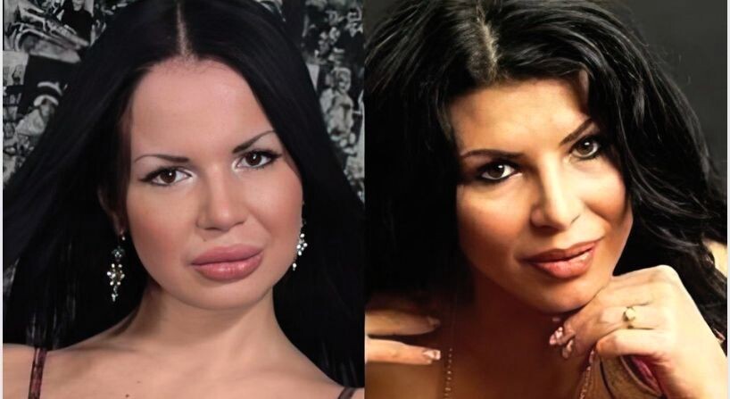 До и после пластики